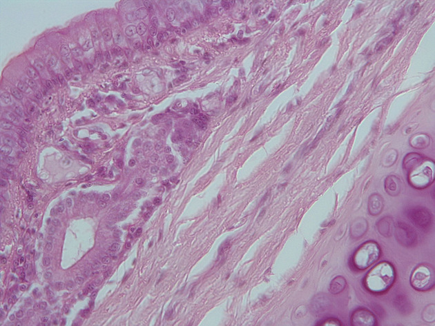 Trachea Slides - Trachea 10 400X